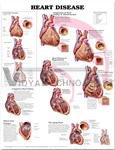 Heart Disease Anatomical Chart, 1st Edition - Paper